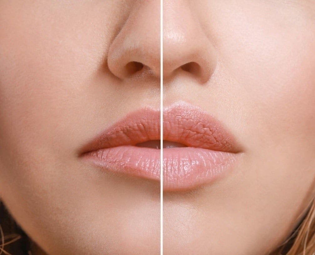 Before and after images showing a woman's lips, highlighting the effects of lip plumping exercises.